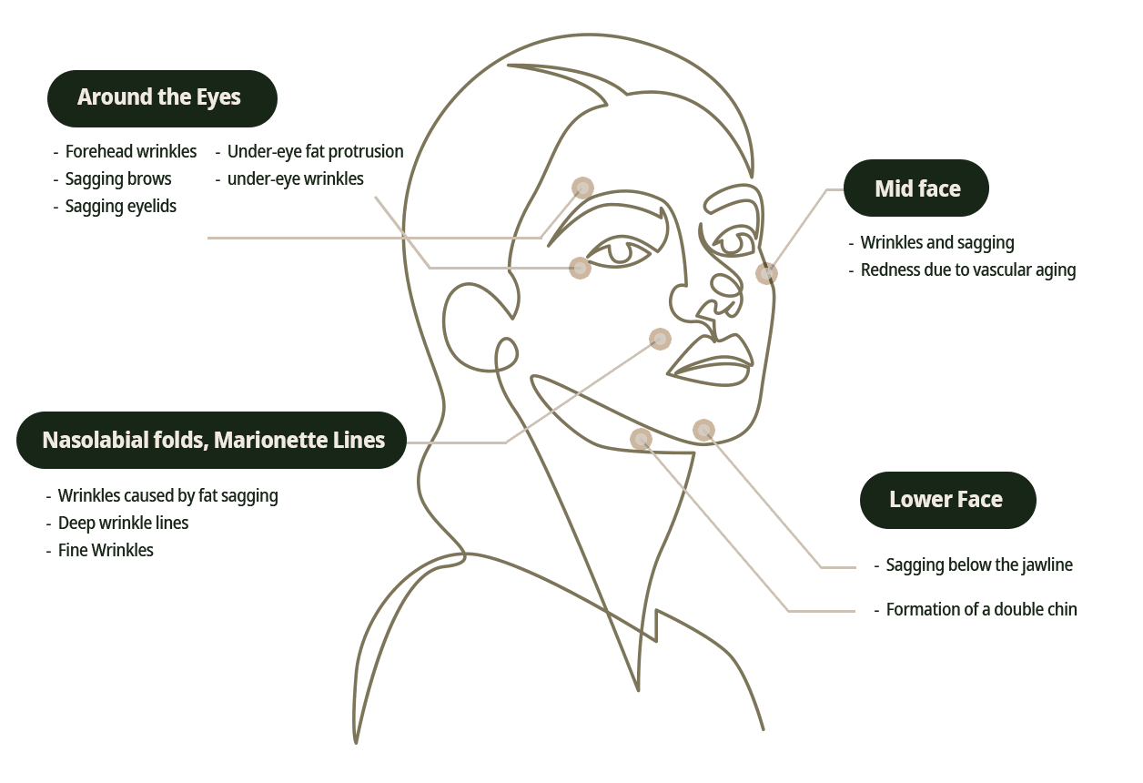 Skin layers addressed by layered lifting — DA Dermatology Dosan